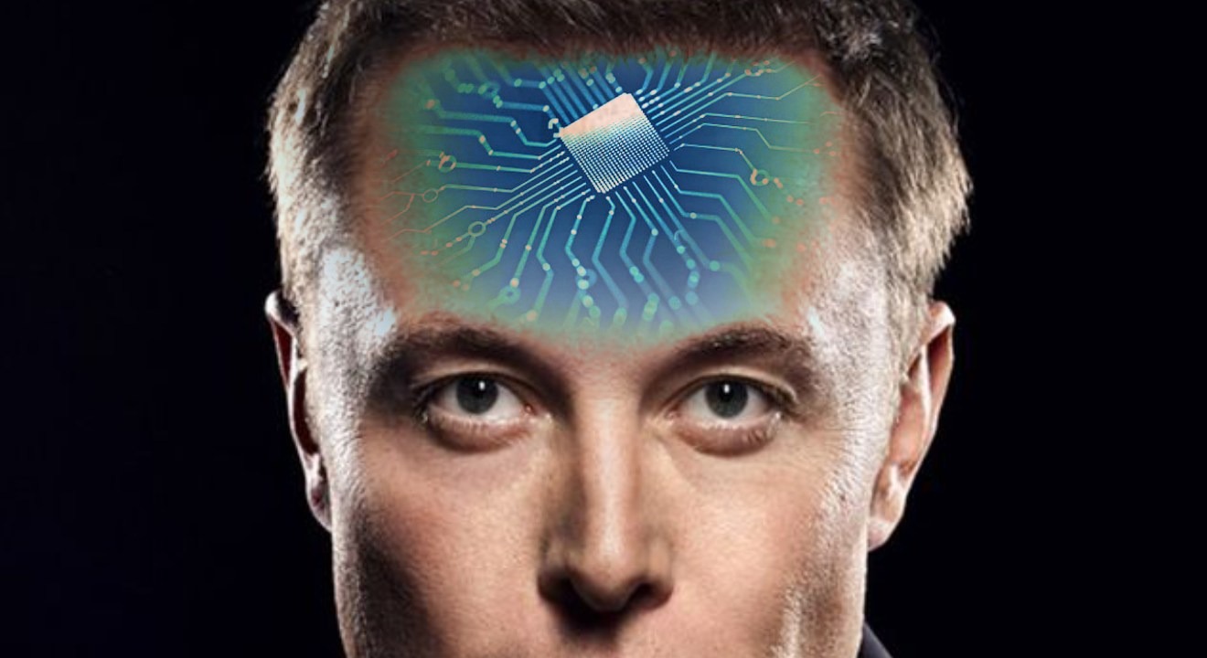 Neuralink, la start-up d'Elon Musk, travaille sur des implants cérébraux. Neuralink, la start-up d'Elon Musk, travaille sur des implants cérébraux.