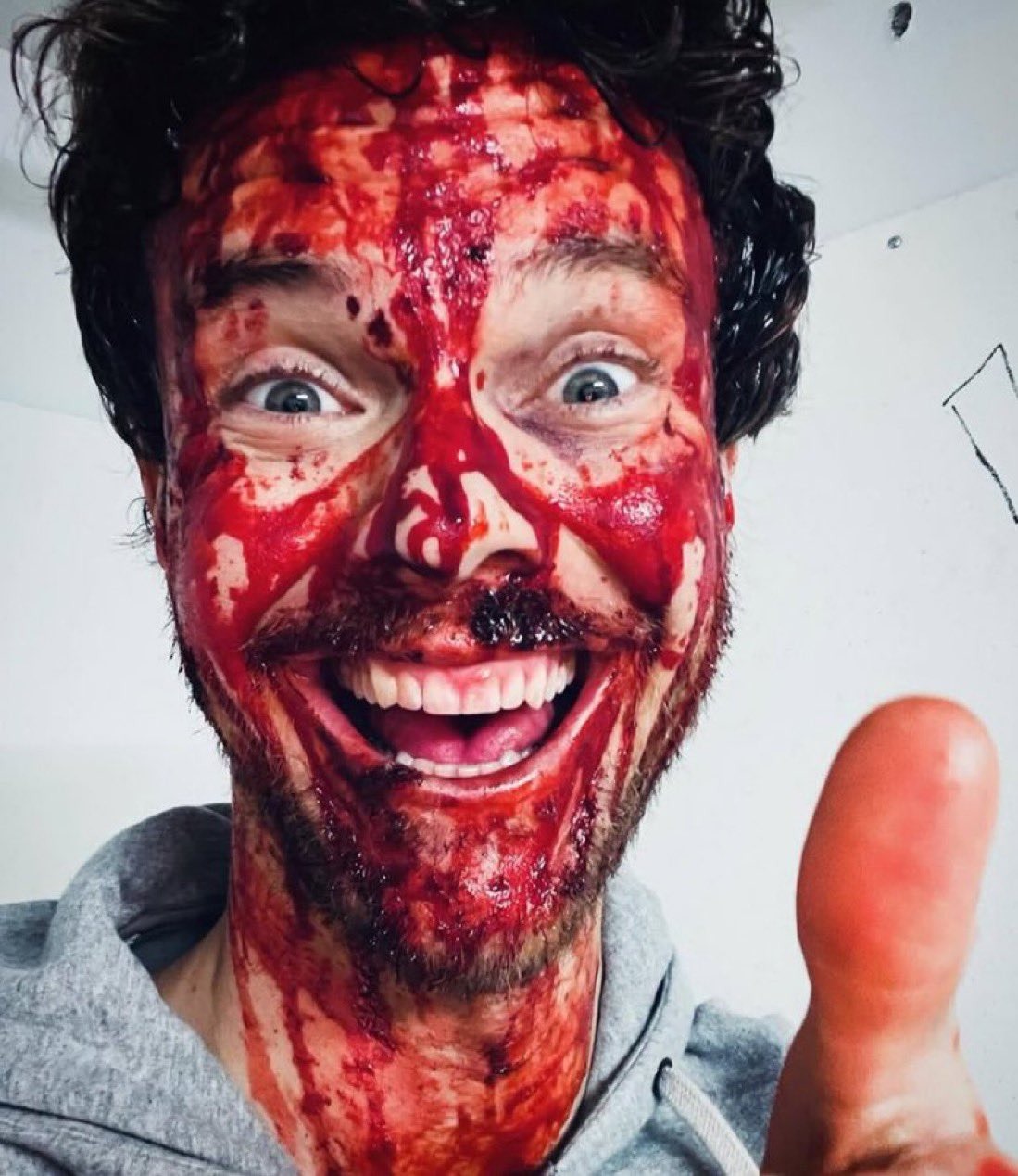 Image du personnage d'Huguie Campbell (Jack Quaid), le visage plein de sang, sur le tournage de la derniÃ¨re saison 5 de The Boys