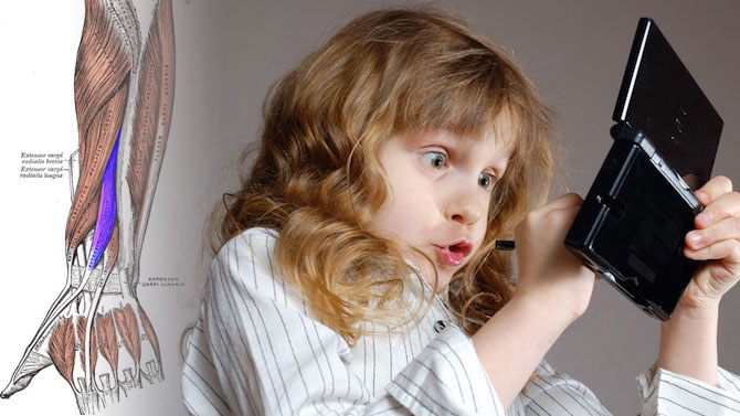 Nintendonite : la pathologie des jeux vidéo officialisée