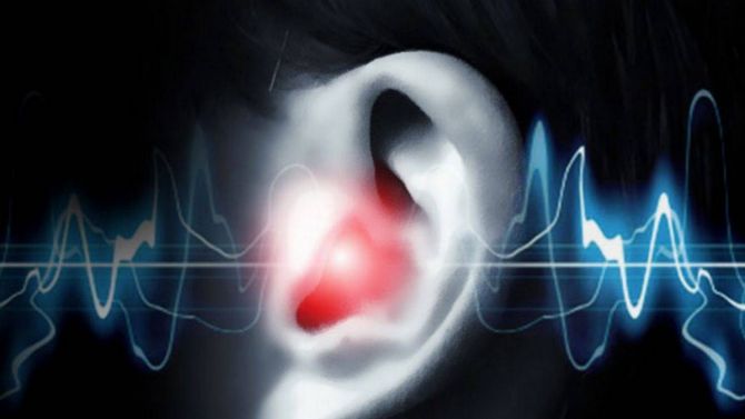 CES 2018 : Diapason, une application pour soigner les acouphènes